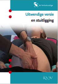 Folder_stuitligging_Nederlands Folder stuitligging Nederlands
